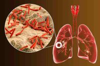 jenis-jenis penyakit menular berisiko kematian