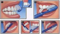 Tips Sikat Gigi yang Benar